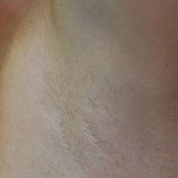 Lazer Beauty, Краматорск Фото - 6