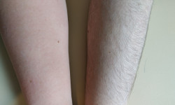 Шугаринг жіночий Майстер депіляції Лина Лупол Вінниця