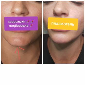 Виктория Врублевская, Вінниця Фото - 18