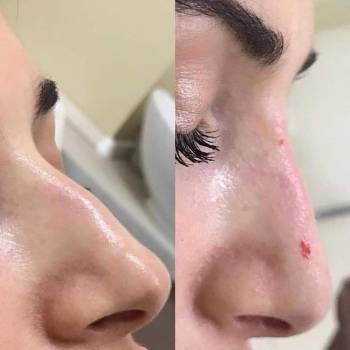 Виктория Врублевская, Вінниця Фото - 24