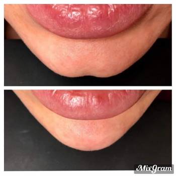 Виктория Врублевская, Вінниця Фото - 2