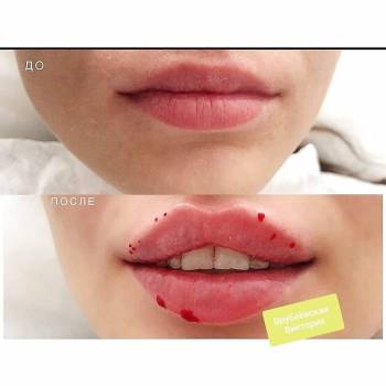 Виктория Врублевская, Вінниця Фото - 13