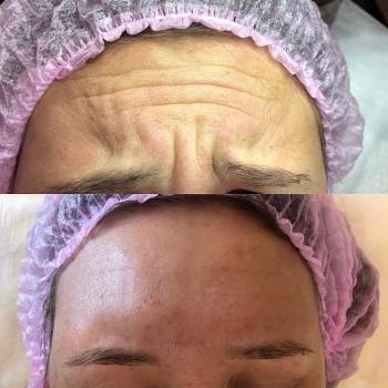 Виктория Врублевская, Вінниця Фото - 1