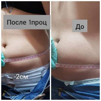 Виктория Врублевская, Вінниця Фото - 11