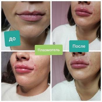 Виктория Врублевская, Вінниця Фото - 7