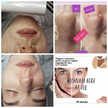 Виктория Врублевская, Вінниця Фото - 3