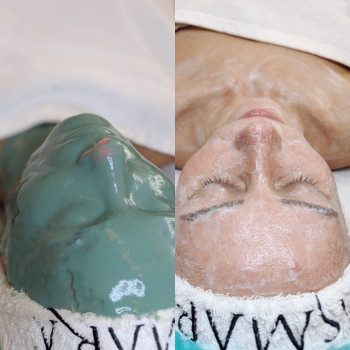 Атравматична чистка обличчя
                    Салон красоты Pure Beauty Львов