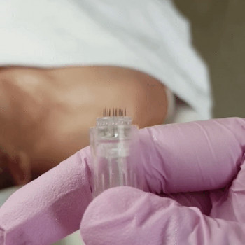 Дермапен (дермаштамп, фракционная мезотерапия)
                    Косметолог-эстетист Марина Сумы