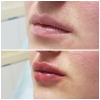 Наталія , Киев Фото - 2