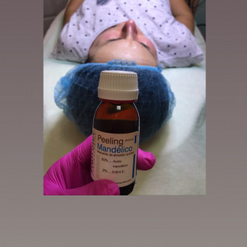 Пилинг
                    Косметолог Елена Кривий Ріг