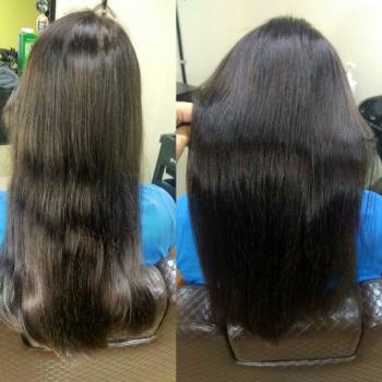 Холодный ботокс