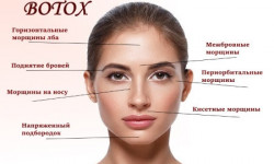 BOTOX/Диспорт Салон краси Wizard Київ