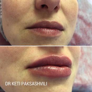 Кетеван Паксашвили , Краматорск Фото - 5