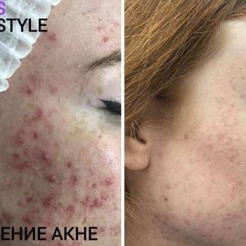 Фото с портфолио Elos Style