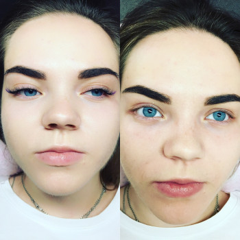 2-3D C,D 0.07 7-12мм