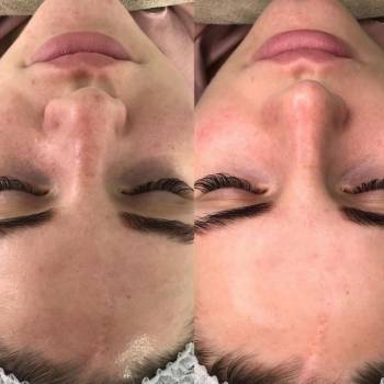 Фото с портфолио Meloli