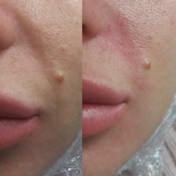 Яна Берлова Берлова, Павлоград Фото - 6