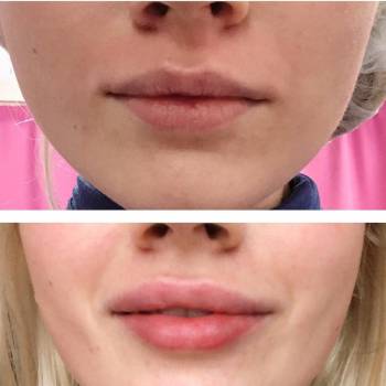 Наталья Славко , Павлоград Фото - 20