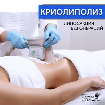 криолиполиз, коррекция фигуры