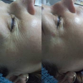 Уход анти-ейдж