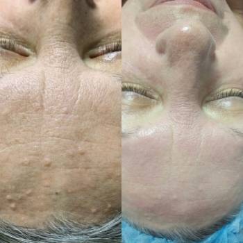 Уход анти-ейдж