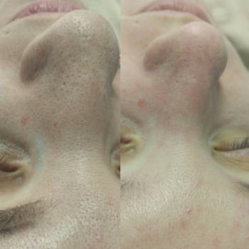 Читска лица