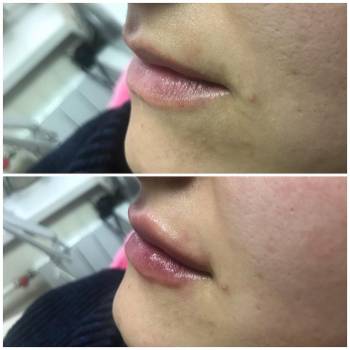 Ольга Евтушок, Житомир Фото - 5