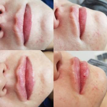 Этуаль, Київ Фото - 27