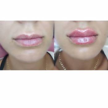 София Яковенко , Бердянськ Фото - 6