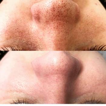 Анна Акриш , Ізмаїл Фото - 6