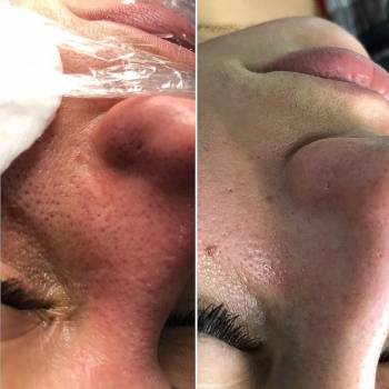 Анна Акриш , Ізмаїл Фото - 7