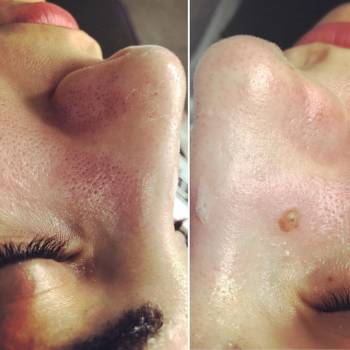 Анна Акриш , Ізмаїл Фото - 8