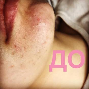 Анна Акриш , Ізмаїл Фото - 9