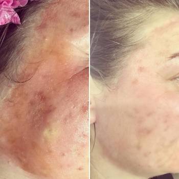 Анна Акриш , Ізмаїл Фото - 10