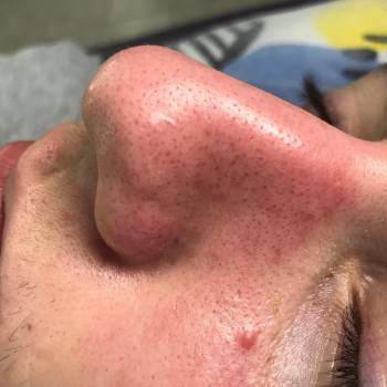 Анна Акриш , Ізмаїл Фото - 11