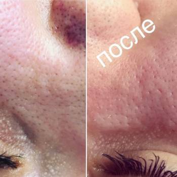 Анна Акриш , Ізмаїл Фото - 12