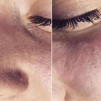 Анна Акриш , Ізмаїл Фото - 13