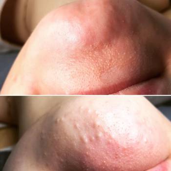 Анна Акриш , Ізмаїл Фото - 14