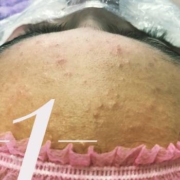 Анна Акриш , Ізмаїл Фото - 16