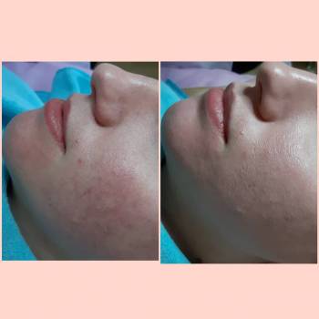 Анна Мухамедова , Бердянск Фото - 6