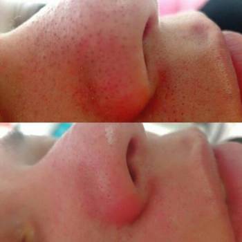 Оксана Линник , Бердянськ Фото - 6