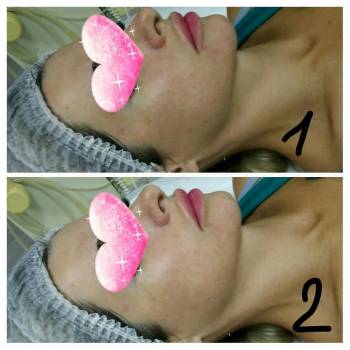 Людмила Терниченко, Бердянськ Фото - 5