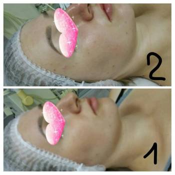 Людмила Терниченко, Бердянськ Фото - 6