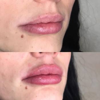 Алиса Гончар , Ізмаїл Фото - 6