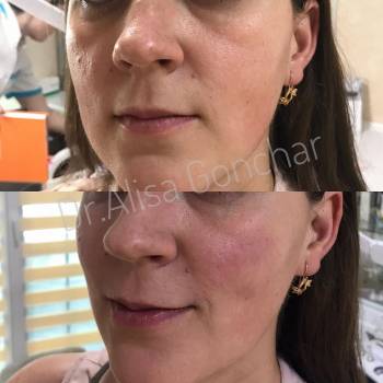 Алиса Гончар , Ізмаїл Фото - 7