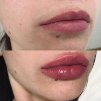 Алиса Гончар , Ізмаїл Фото - 8