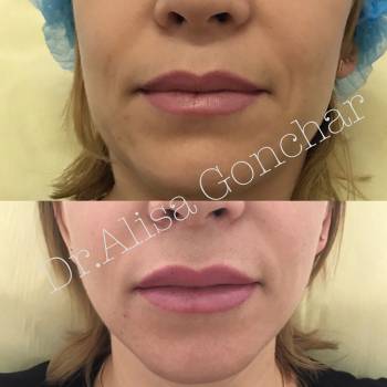 Алиса Гончар , Ізмаїл Фото - 9