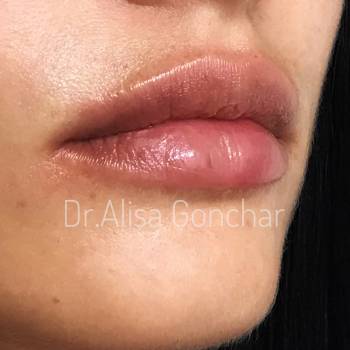 Алиса Гончар , Ізмаїл Фото - 10