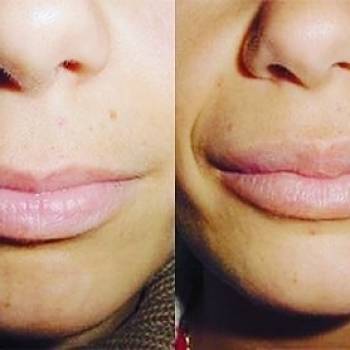 Студия татуажа Виктории Громовой, Харьков Фото - 20