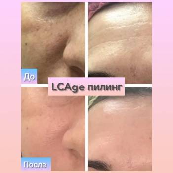 Фото с портфолио Альбина Белоусова 